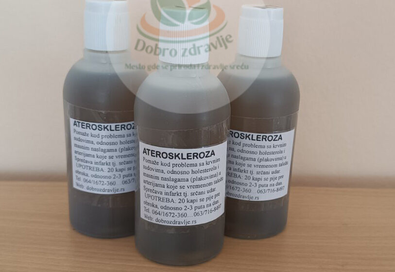 ateroskleroza kapi